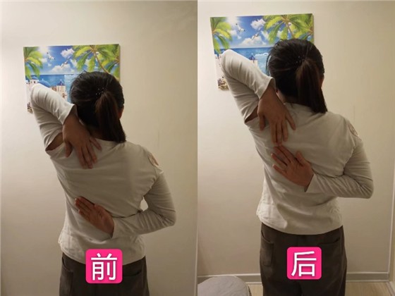 颈肩/腰腿痛症理疗案例