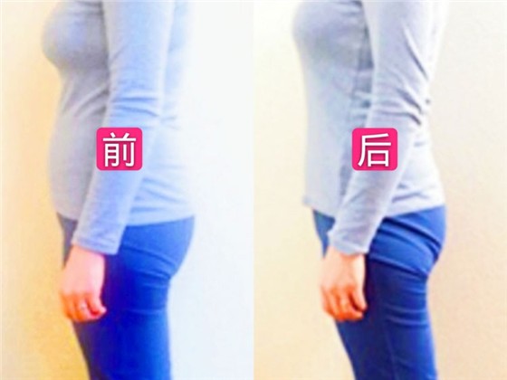 产后徒手塑形前后对比
