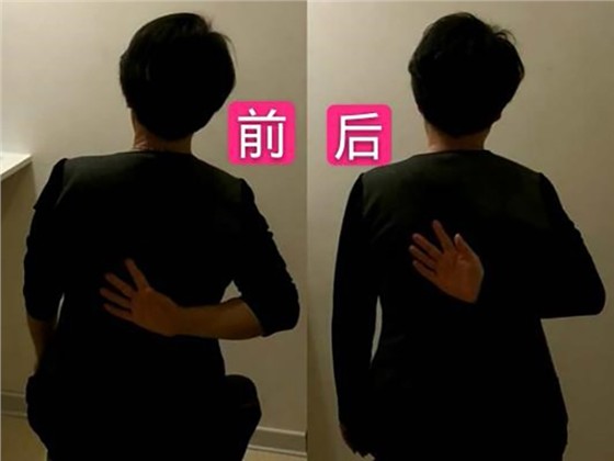 肩周炎理疗前后对比