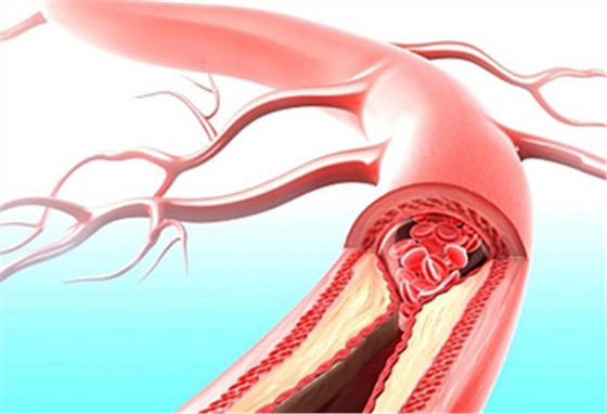 手法调理，活血散淤，缓解痛经
