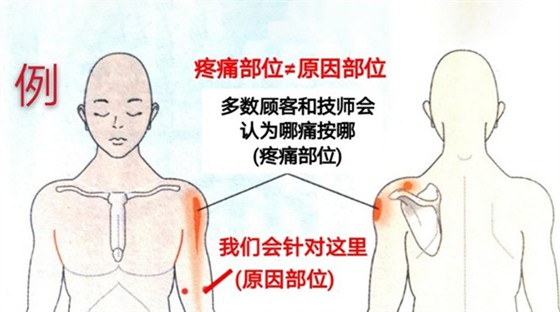 痛症理疗误区