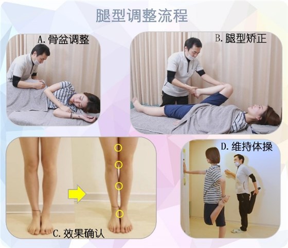 日式O/X型腿矫正