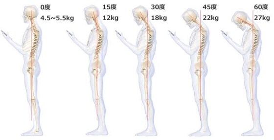 含胸驼背的原因