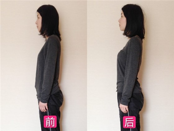 日式含胸驼背矫正