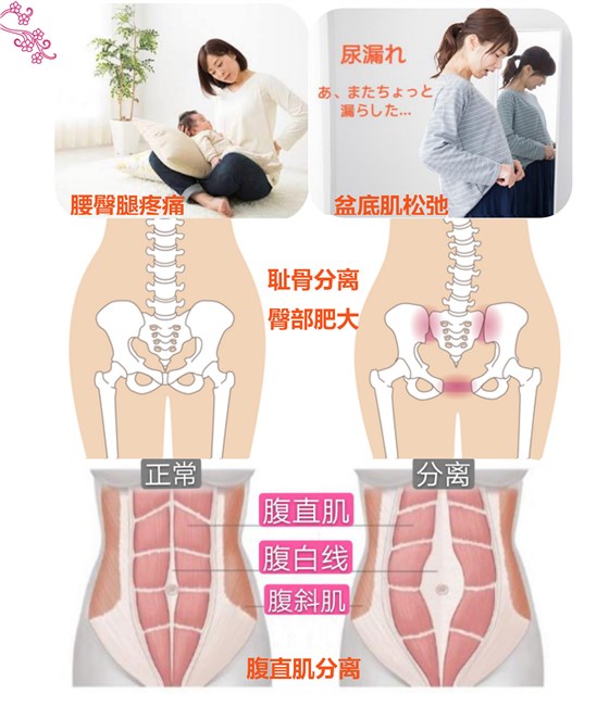 典型的产后症状