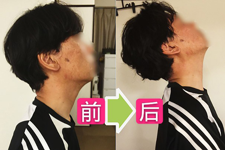 日式关联痛技法保健按摩案例