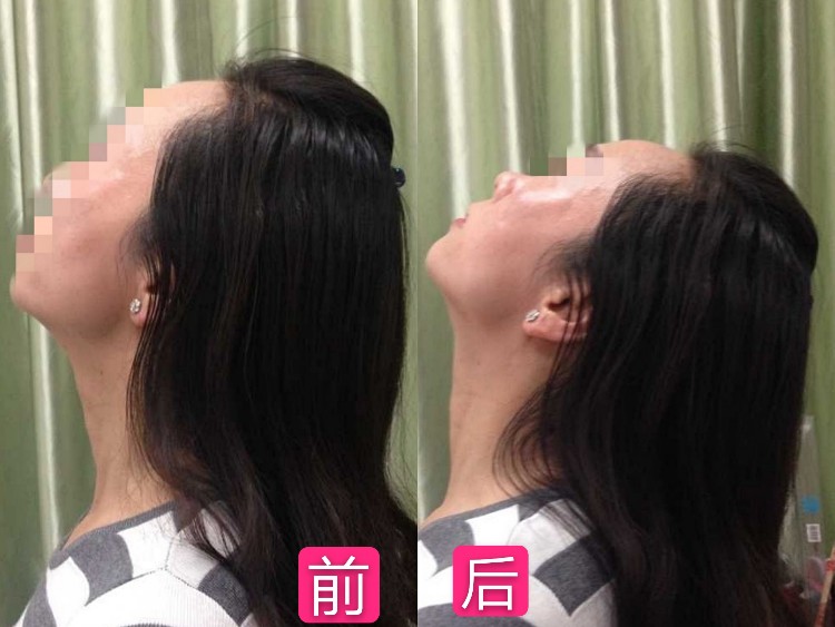 颈肩/腰腿痛症理疗案例