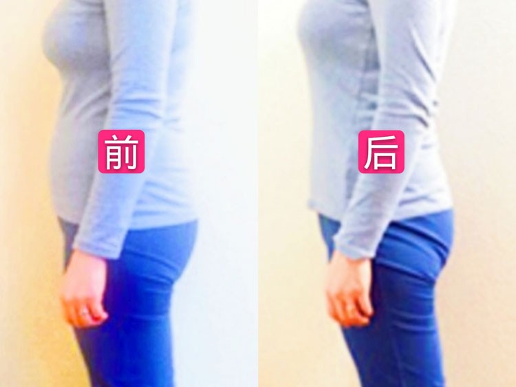 纤腰提臀收胯产后徒手塑形技法案例