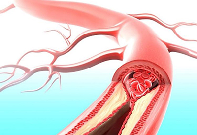 手法调理，活血散淤，缓解痛经
