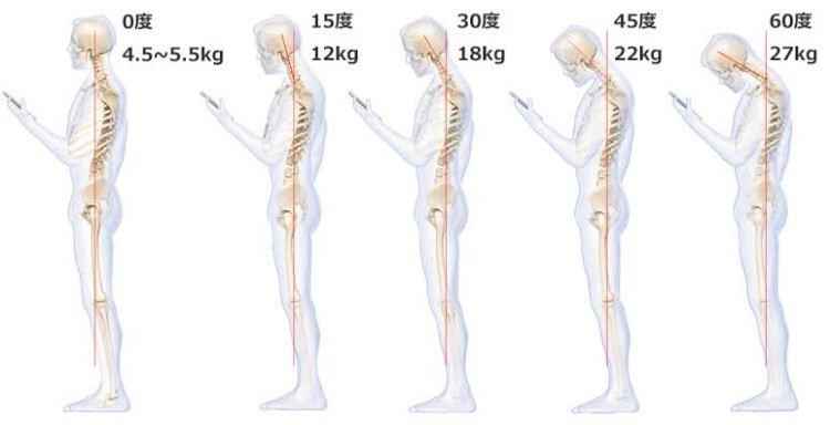 含胸驼背的原因